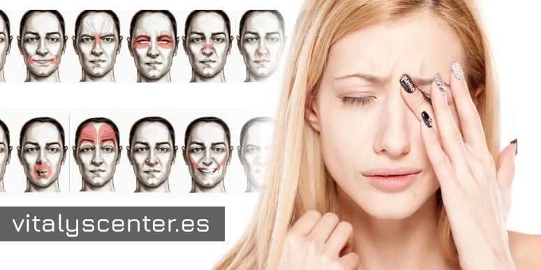 Qué es una parálisis facial